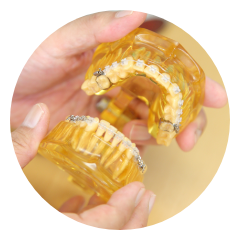 適切な矯正装置・方法を提案