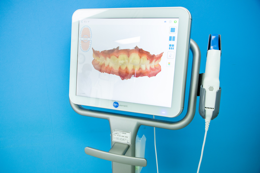 3D光学スキャナー「iTero（アイテロ）」を導入